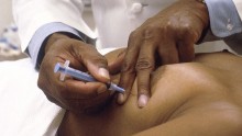 A needle biopsy of a breast 