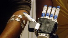 3D-printed prosthetic hand 