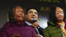 Chinese philanthropist Chen Guangbiao (c.) speaks during a news conference announcing his underwriting for the full surgical regimen of mother and daughter, Hao Huijun (l.) and Chen Guo (r.), who were disfigured by a self-immolation in 2001.