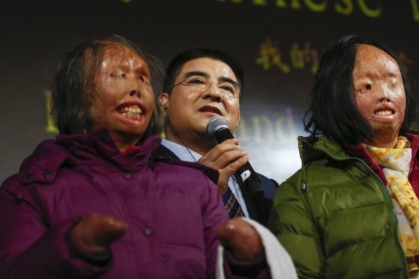 Chinese philanthropist Chen Guangbiao (c.) speaks during a news conference announcing his underwriting for the full surgical regimen of mother and daughter, Hao Huijun (l.) and Chen Guo (r.), who were disfigured by a self-immolation in 2001.