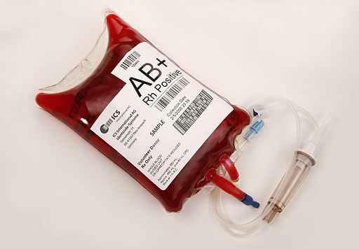 Blood bag that requires anticoagulants such as heparin for the blood to stay liquid