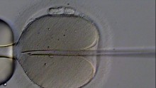 In vitro fertilization