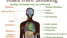 Risks from smoking