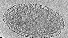 An ultra-small bacteria cell unlike anything ever seen.
