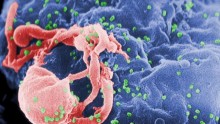 HIV Antibodies