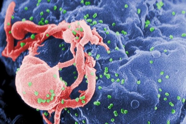 HIV Antibodies