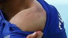 A close-up look on Italian player Giorgio Chiellini shoulders clearly showing bite marks