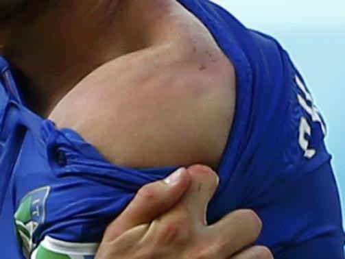 A close-up look on Italian player Giorgio Chiellini shoulders clearly showing bite marks