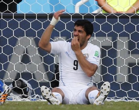 Uruguay's Luis Suarez holding his teeth after hitting Italian player on shoulders