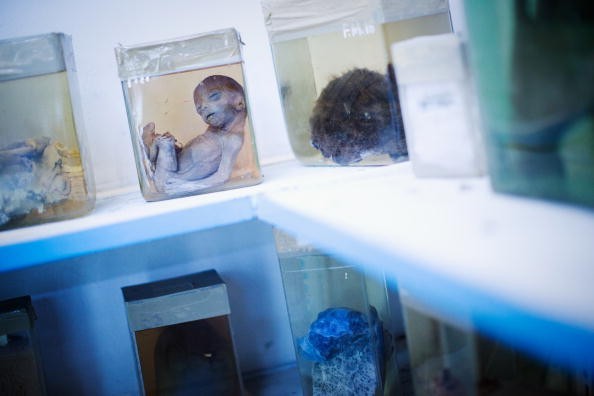 Fetus And Specimens In Embalming Fluid