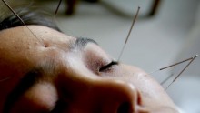 Rat Experiment Help Unravel The Mystery of Acupuncture Treatment