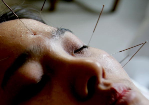 Rat Experiment Help Unravel The Mystery of Acupuncture Treatment
