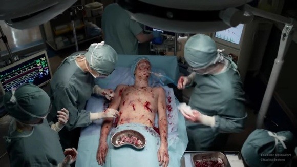 Evan Moore on the operating table is being attended by doctors in the last scene of "iZombie" Season 1 when Liv refuses to give him her blood.