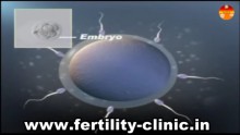 The in vitro fertilization as one of the reproductive techniques is being discussed.