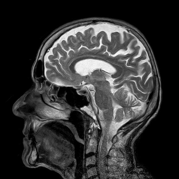 Male or female brain? New study reveals that brains have no gender distinction.