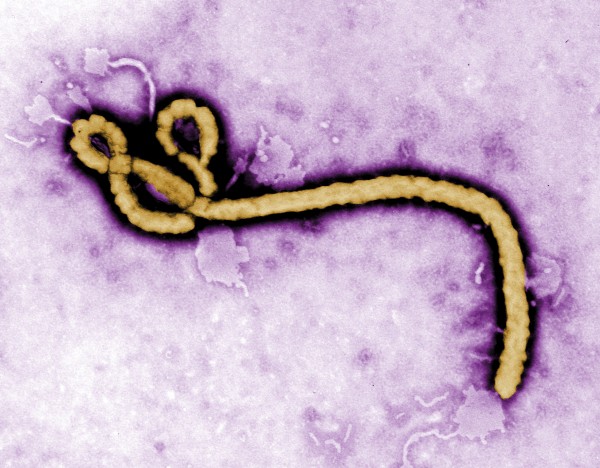 Some of the ultrastructural morphology displayed by an Ebola virus