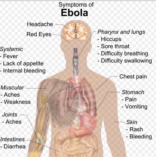 Ebola symptoms