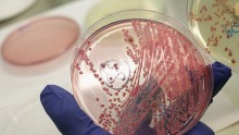 US reported its first case of last resort antibiotic resistant bacteria.