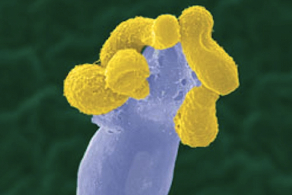 cryptococcus-gattii